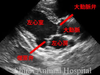 超音波心臓内画像